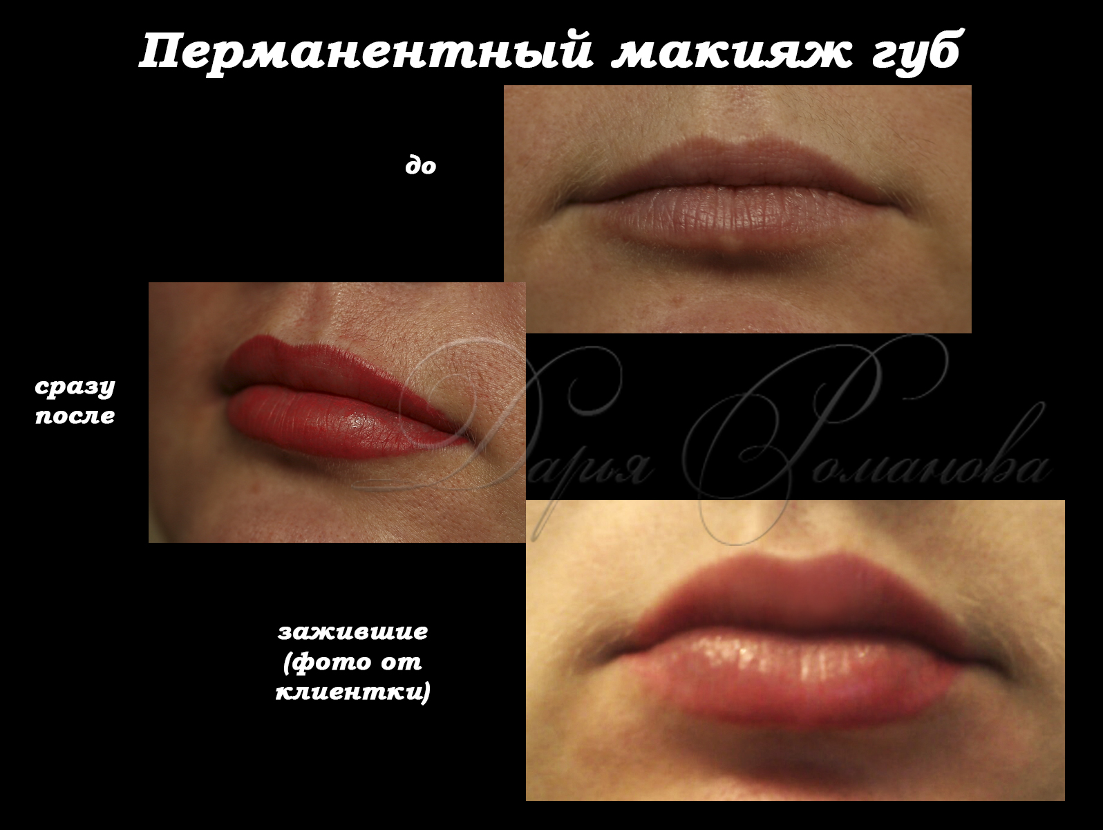 Перманентный макияж губ: виды, отзывы косметологов, фото татуажа до процедуры и после заживления | ddick.ru