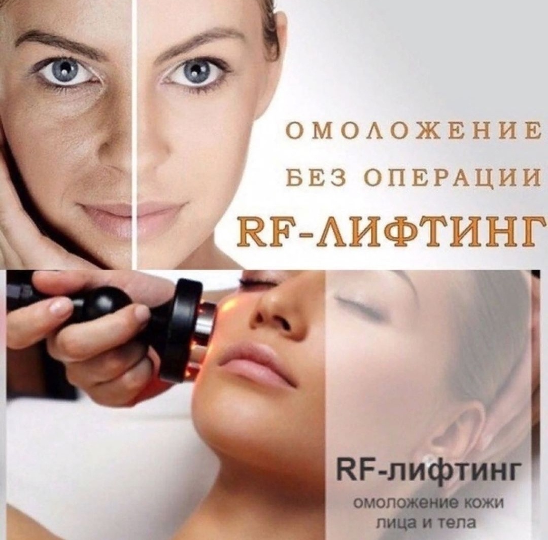 Что такое rf-лифтинг и кому он подходит - monte rosso
