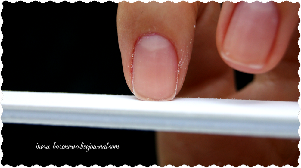 Что делать при травме ногтя?