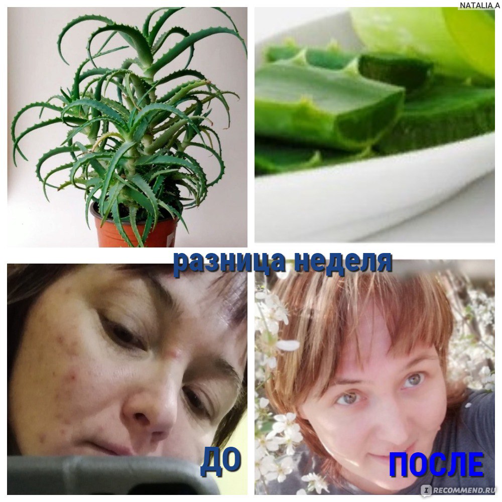 Маски из меда и алоэ для лица, рецепты в домашних условиях