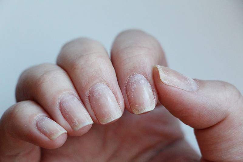 Каким образом можно восстановить ногти после шеллака?