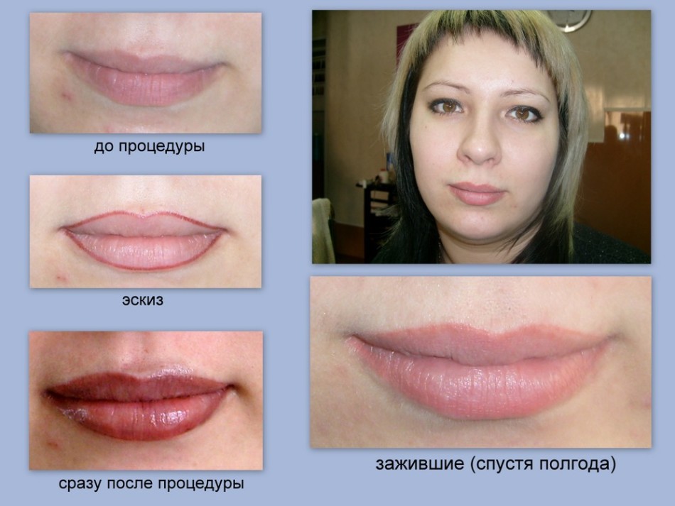 Татуаж губ фото до и после процедуры, различные техники нанесения