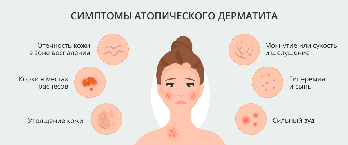 Шелушатся губы: причины, дополнительные симптомы, лечение, профилактика