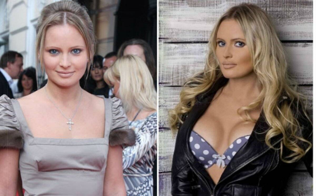 Звезды после неудачной пластики – фото российских знаменитостей до и после пластических операций