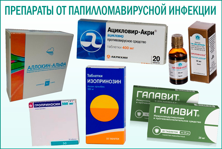 Папилломы: симптомы, причины, диагностика, лечение и профилактика