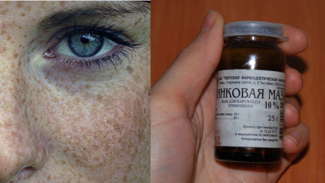 Травы для умывания лица от морщин