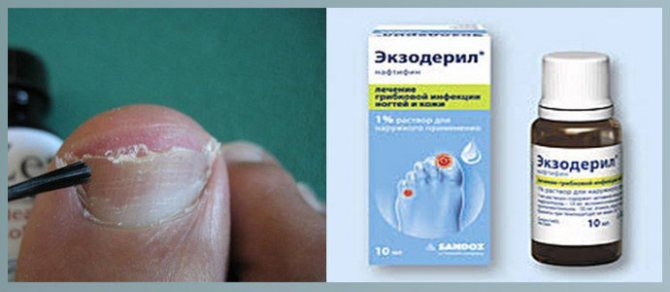 Экзодерил От Грибка Цена