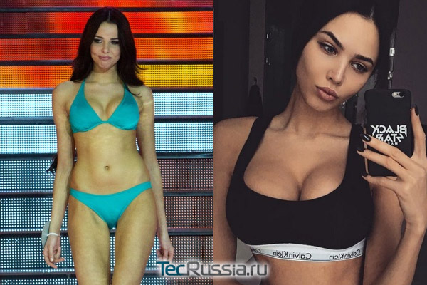 Звезды, которые не делали пластику