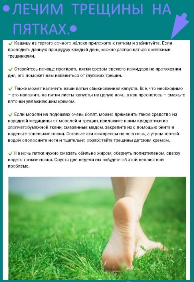 Глубокие трещины на пятках, лечение в домашних условиях быстро с помощью 15 рецептов