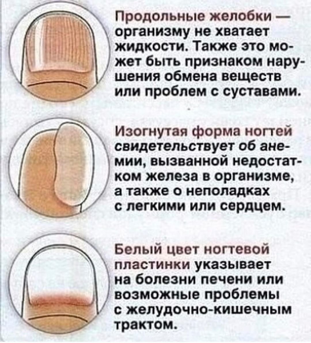 Продольные полосы на ногтях рук: причины и лечение, профилактические мероприятия, уход | mfarma.ru