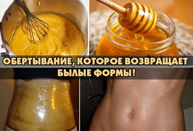 Медовые обертывания против целлюлита - медовое наслаждение для тела