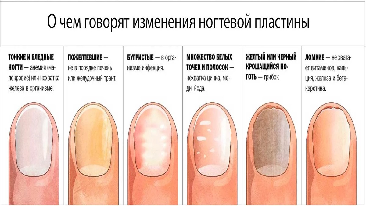 Из чего состоят ногти человека и что они могут рассказать о здоровье? - hi-news.ru