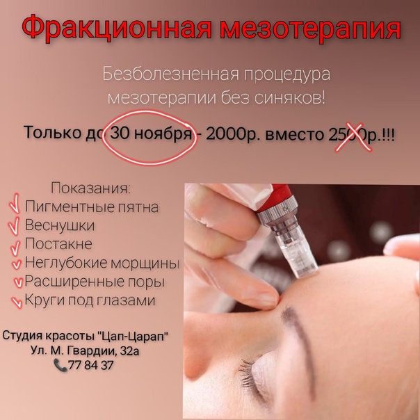 Что такое фракционная мезотерапия кожи лица: эффективность процедуры и показания