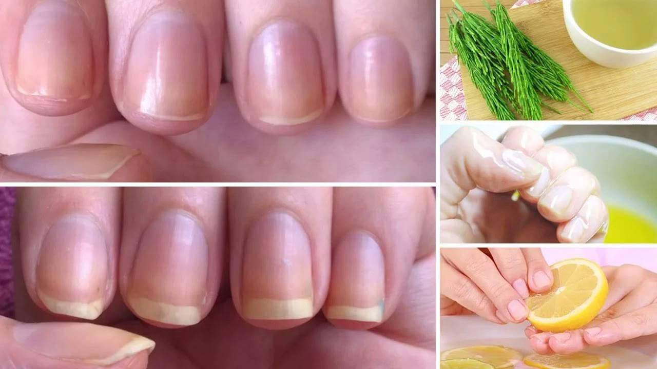 Как укрепить ногти в домашних условиях простыми рецептами