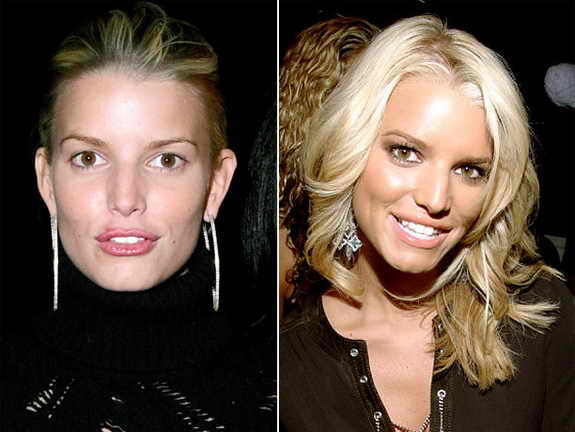 Джессика симпсон до и после пластических операций, фото и видео джессика симпсон: изменения лица и тела звезды