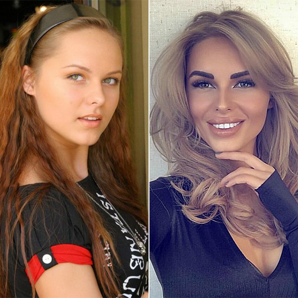 Как менялась ханна: певица до и после пластики