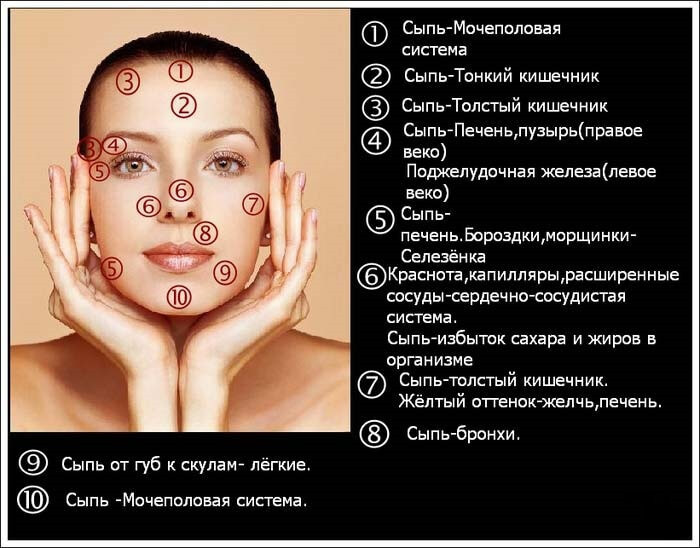 Причина прыщей на подбородке у женщин, лечение :: syl.ru