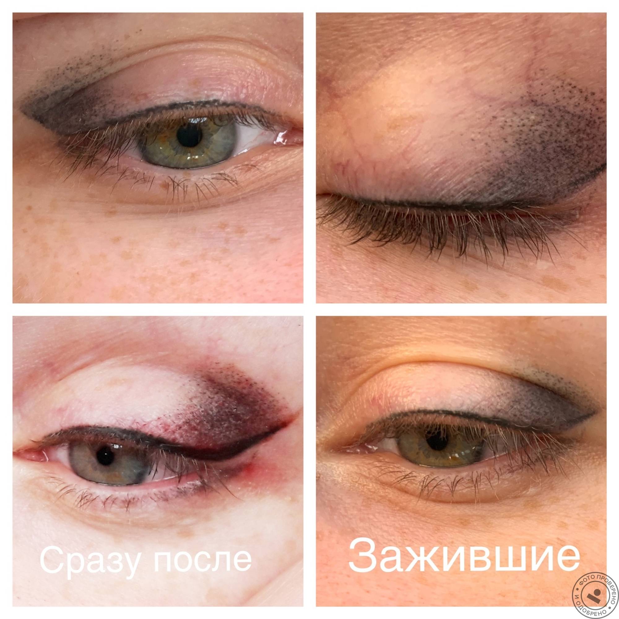 Татуаж глаз и век - все о процедуре, фото до и после