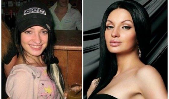 Удивительное преображение Феофилактовой: фигура до и после пластической хирургии