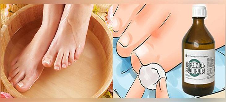 Чистотел против грибка ногтей на ногах: лечение соком и маслом