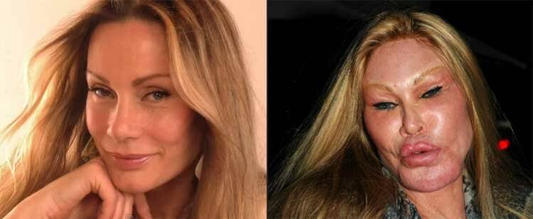Джослин вильденштейн до и после пластики – фото в молодости и сейчас