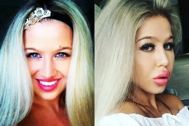 Малиновская маша до и после пластики, неудачная операция, внешность в 2021, почему она стала жертвой