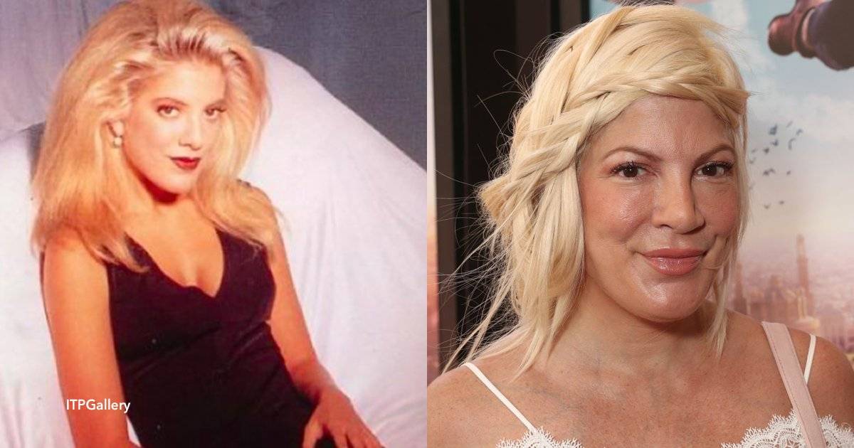 После пластической операции певица анна семенович стала похожа на лободу и шерон стоун одновременно