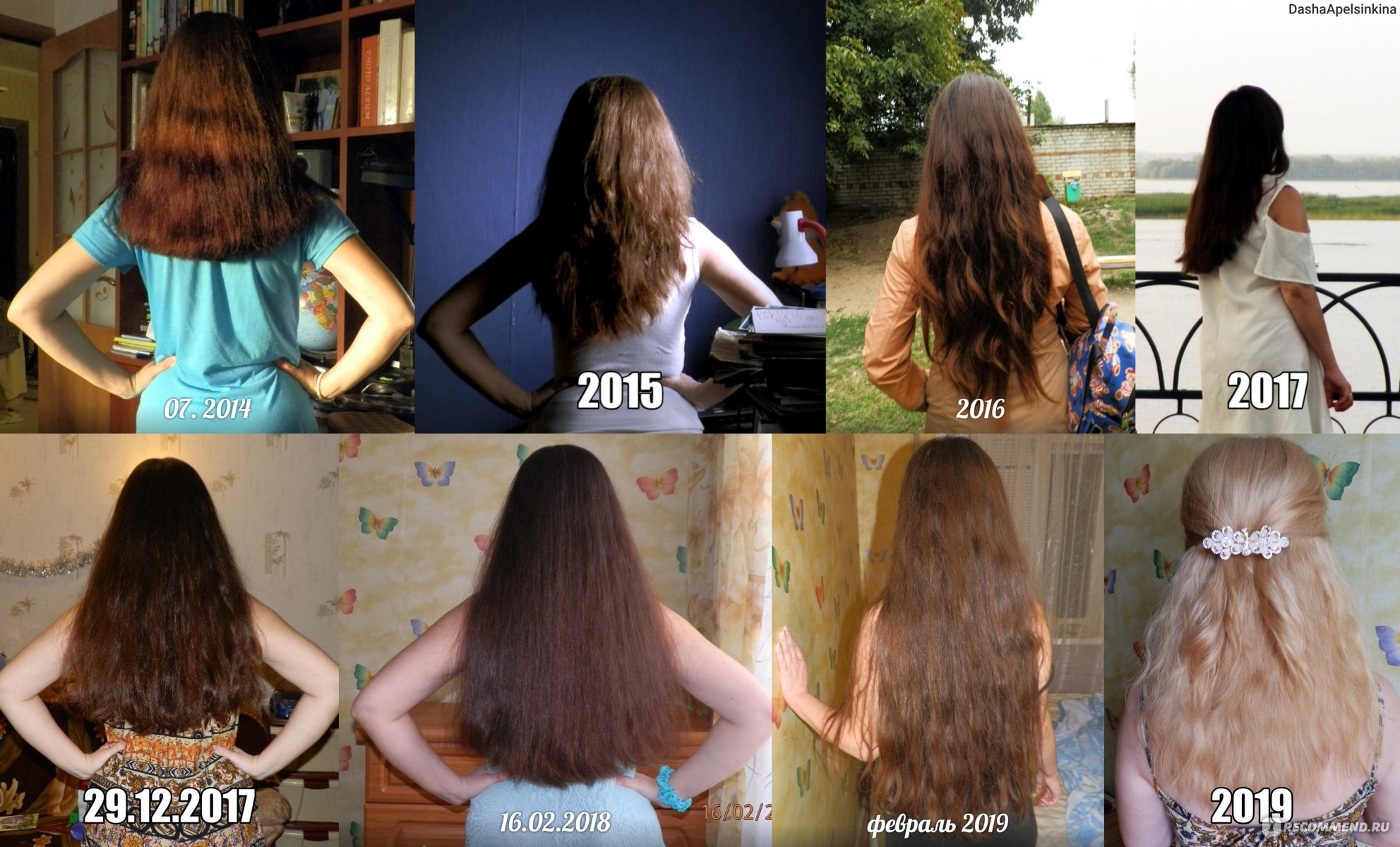 На сколько отрастают волосы за год, стадии роста, советы трихолога по уходу