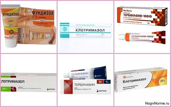 Онихомикоз: советы доктора о профилактике грибка ногтей
