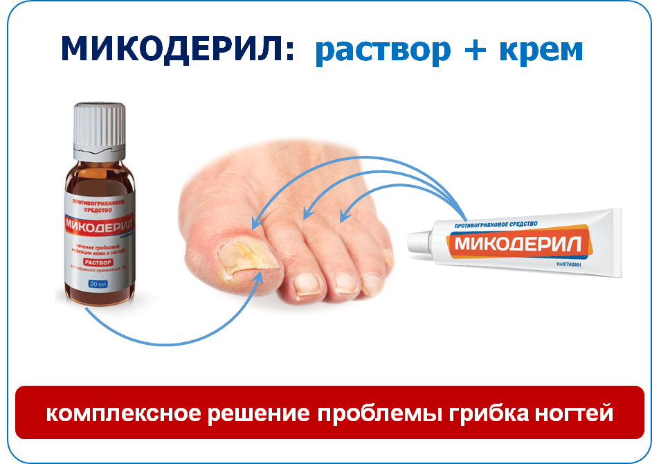 Микодерил для лечения грибка ногтей: инструкция и отзывы